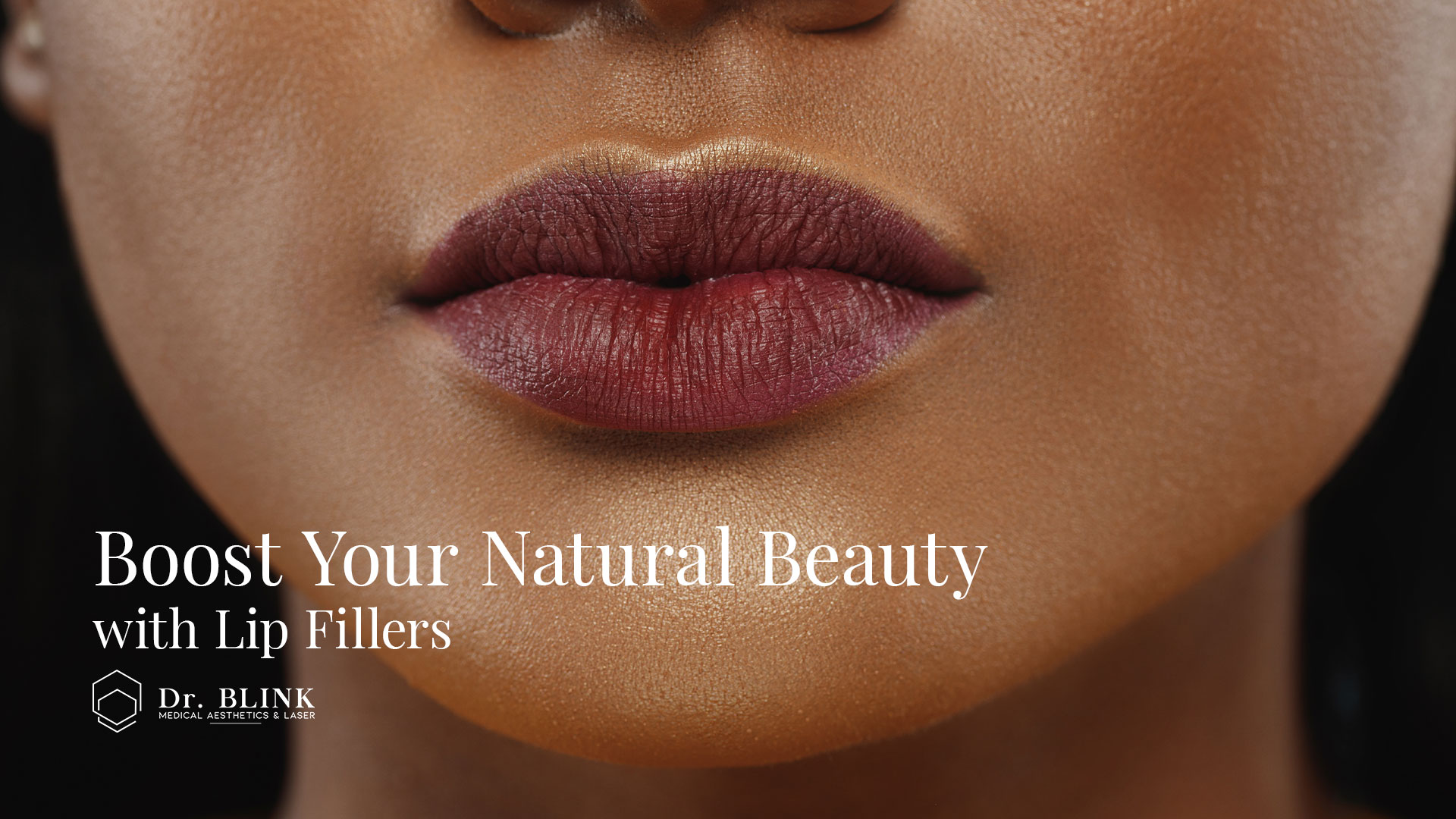 Boost Your Natural Beauty with Lip Fillers by Dr Blink