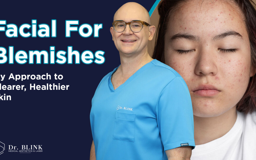 Facial for Blemishes: My Approach to Clearer, Healthier Skin