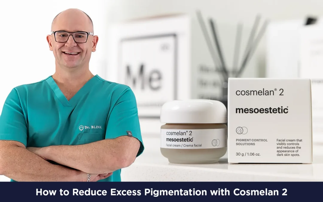 How to Reduce Excess Pigmentation with Cosmelan 2