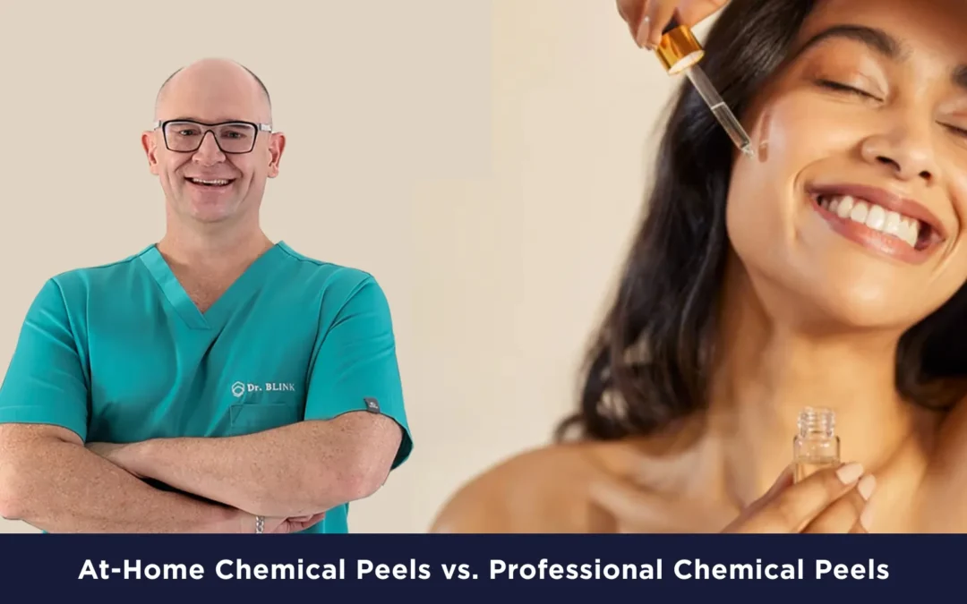 At-Home Chemical Peels vs. Professional Chemical Peels