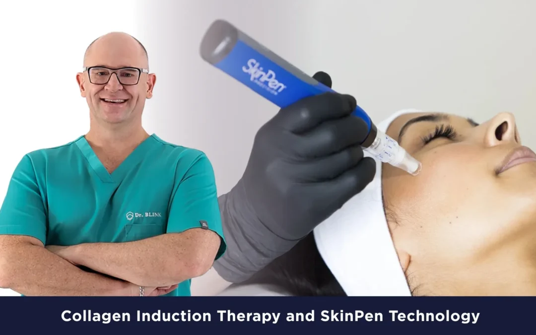 Collagen Induction Therapy and SkinPen Technology