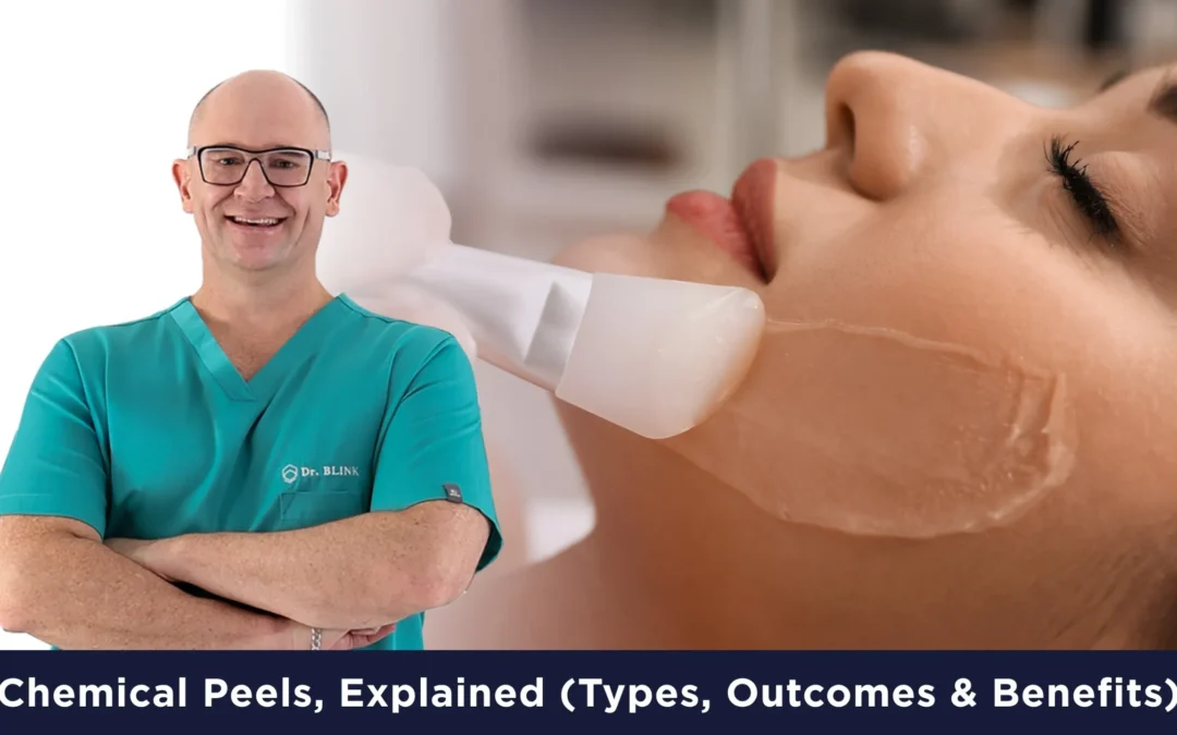 Chemical Peels, Explained (Types, Benefits & Outcomes)